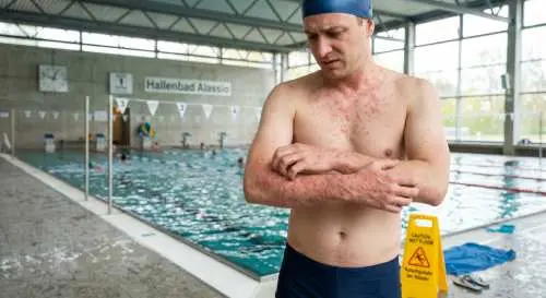 Die Betriebshaftpflicht für ein Schwimmbad deckt Personenschaden ab.